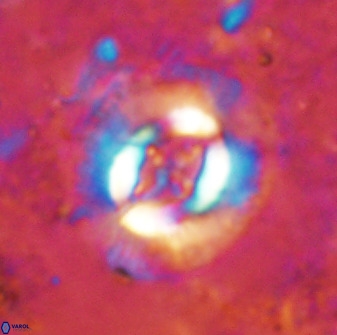 Cruciplacolithus intermedius 49959