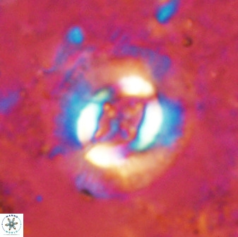 Cruciplacolithus intermedius 49959