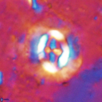 Cruciplacolithus intermedius 49953