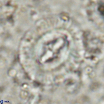 Cruciplacolithus intermedius 49960