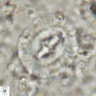 Cruciplacolithus intermedius 49960