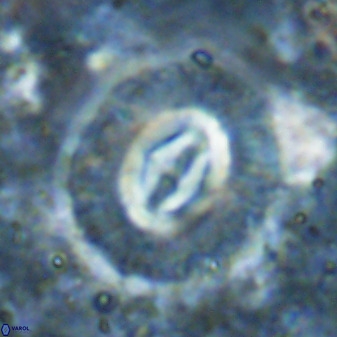 Cruciplacolithus intermedius 49963