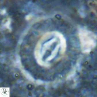 Cruciplacolithus intermedius 49963
