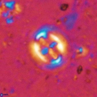 Cruciplacolithus intermedius 50967
