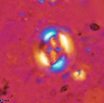 Cruciplacolithus intermedius 50968