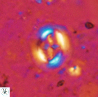 Cruciplacolithus intermedius 50968