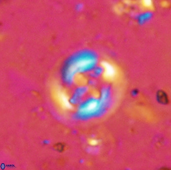 Cruciplacolithus intermedius 50971