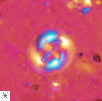 Cruciplacolithus intermedius 50971