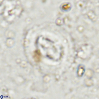 Cruciplacolithus intermedius 50972