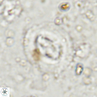 Cruciplacolithus intermedius 50972