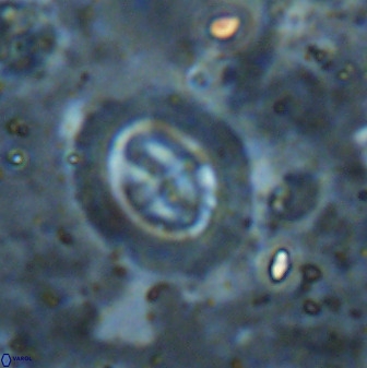 Cruciplacolithus intermedius 50973