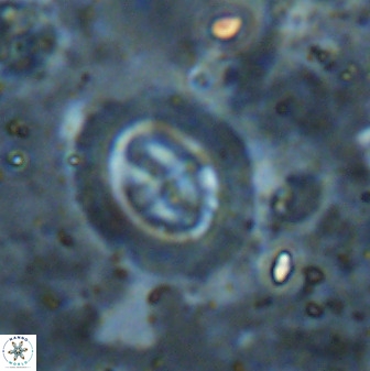 Cruciplacolithus intermedius 50973