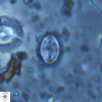 Cruciplacolithus kanungoi VR 16479