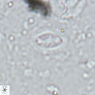Cruciplacolithus kanungoi VR 16484