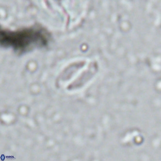 Cruciplacolithus kanungoi VR 16486