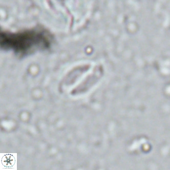 Cruciplacolithus kanungoi VR 16486