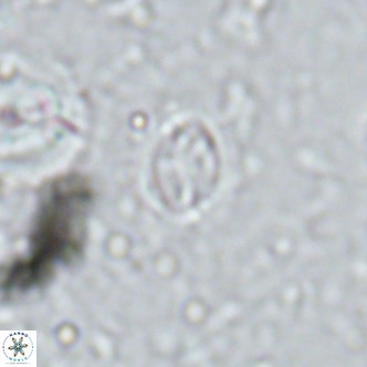 Cruciplacolithus kanungoi VR 16487