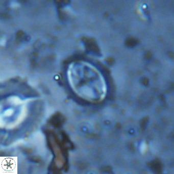 Cruciplacolithus kanungoi VR 16480