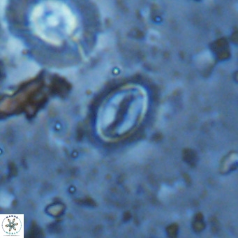 Cruciplacolithus kanungoi VR 16481