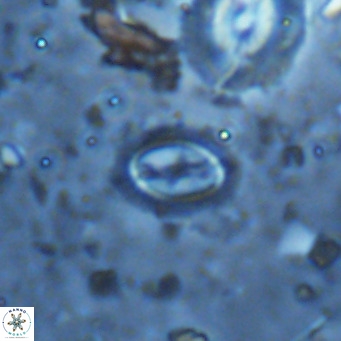 Cruciplacolithus kanungoi VR 16482