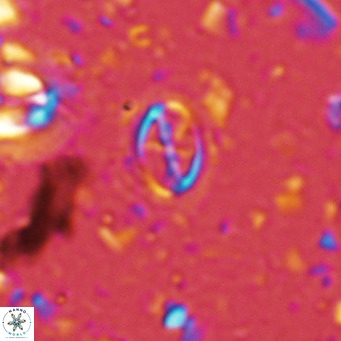 Cruciplacolithus kanungoi VR 16495