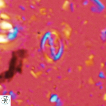 Cruciplacolithus kanungoi VR 16498