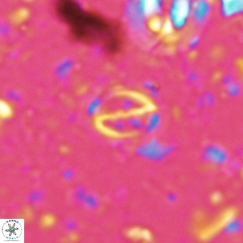 Cruciplacolithus kanungoi VR 16505