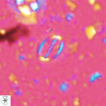 Cruciplacolithus kanungoi VR 16502