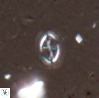 Cruciplacolithus kanungoi 26487
