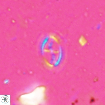 Cruciplacolithus kanungoi 26488
