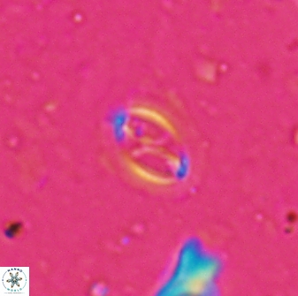 Cruciplacolithus kanungoi 26489