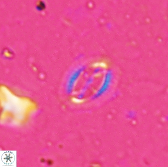Cruciplacolithus kanungoi 26492