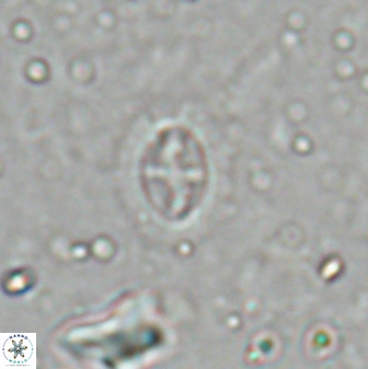 Cruciplacolithus kanungoi 26493