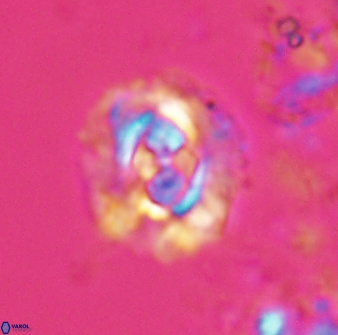 Cruciplacolithus latipons 23117