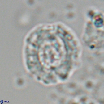 Cruciplacolithus latipons 23124