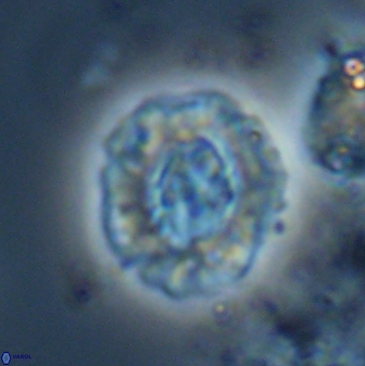 Cruciplacolithus latipons 23125