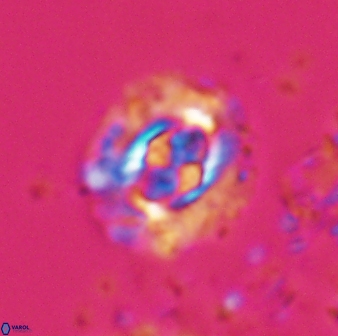 Cruciplacolithus latipons 23120