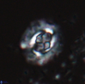 Cruciplacolithus latipons 23121