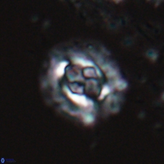 Cruciplacolithus latipons 23122