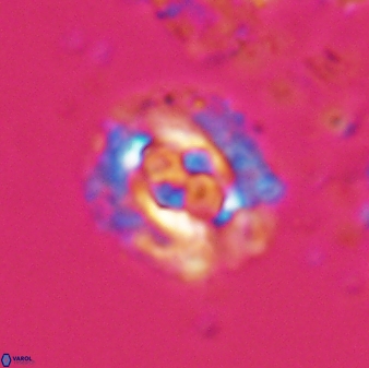 Cruciplacolithus latipons 23123