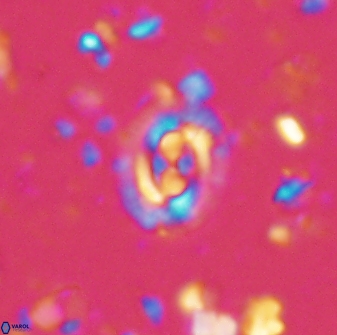 Cruciplacolithus latipons 42964