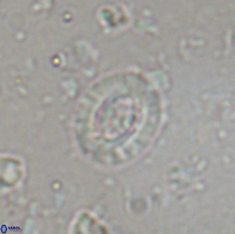 Cruciplacolithus latipons 42974