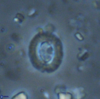 Cruciplacolithus latipons 42970