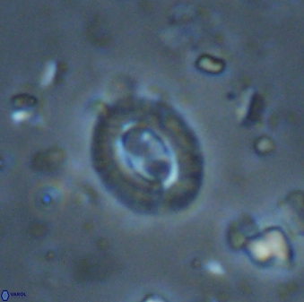 Cruciplacolithus latipons 42971