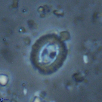 Cruciplacolithus latipons 42972