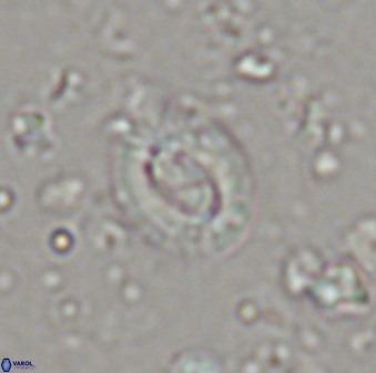 Cruciplacolithus latipons 42973