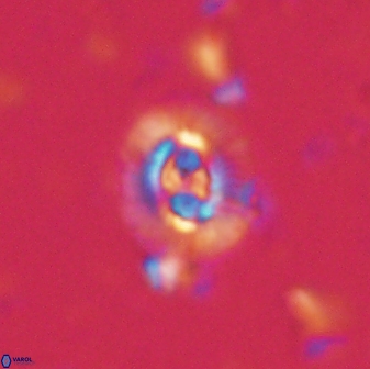 Cruciplacolithus latipons 59824