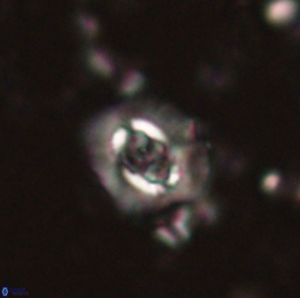 Cruciplacolithus latipons 59825