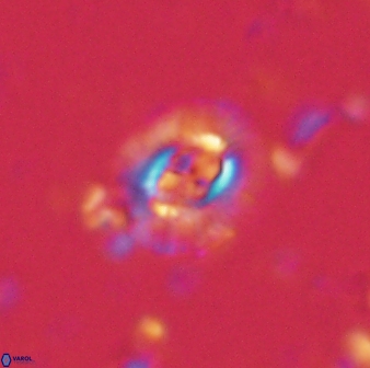 Cruciplacolithus latipons 59828