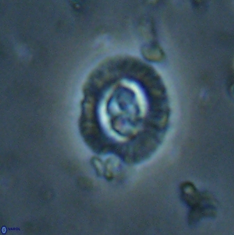 Cruciplacolithus latipons 59832